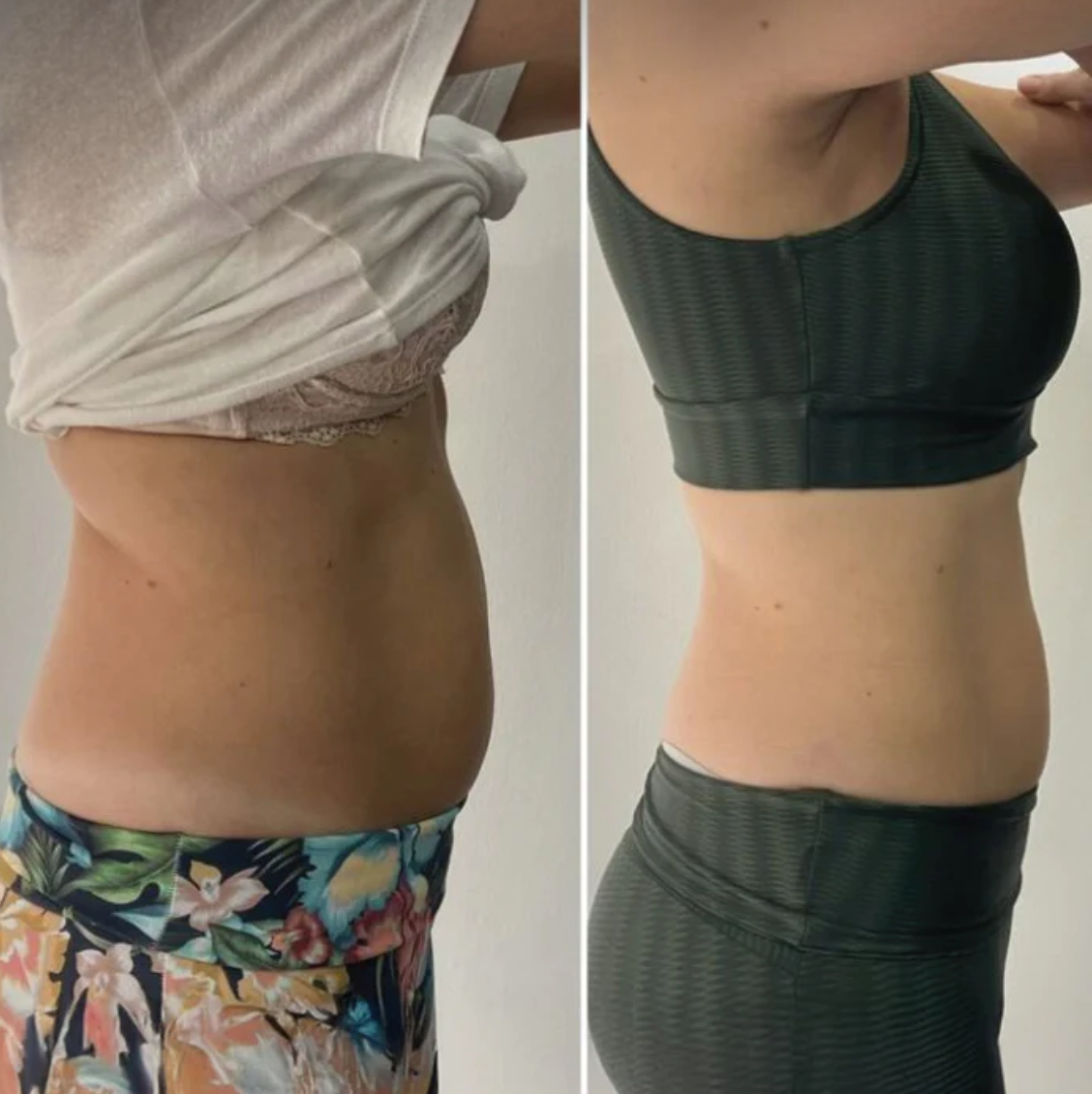 Lymphatic Drainage Massager